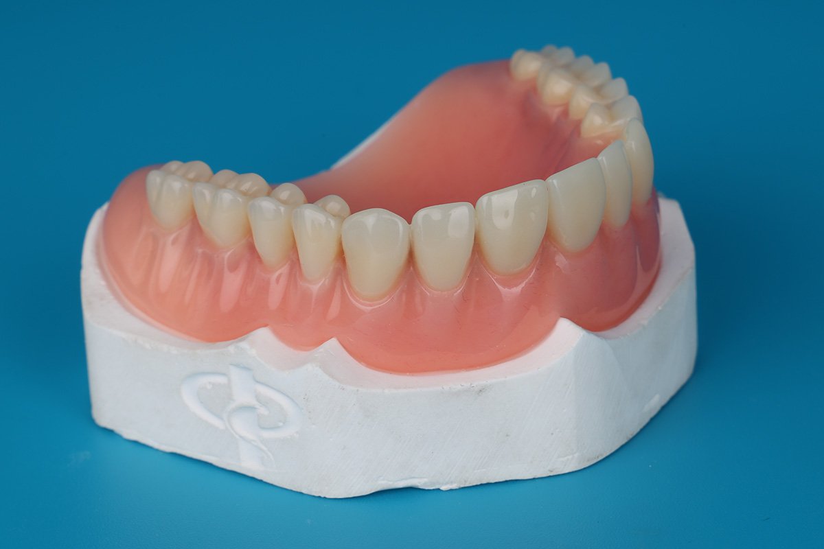 Prothèses Adjointes